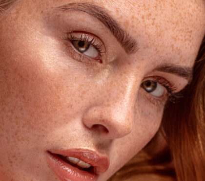 An image of a ginger woman after the Blepharoplasty (Eyelid Surgery) at Longview Plastic Surgery.