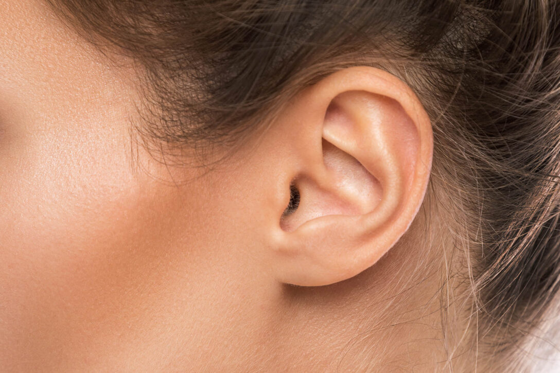 Otoplasty in Longview, TX - Cosmetic Ear Surgery Near You - Cupped Ear ...